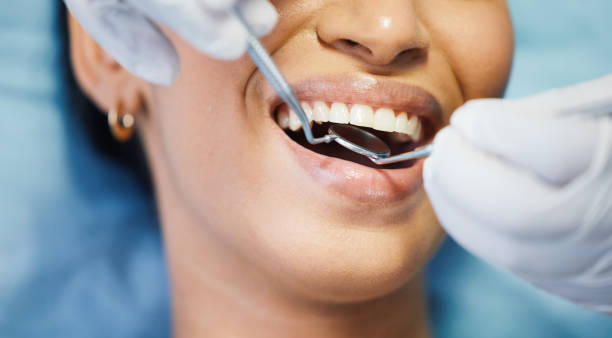 Best Knocked-Out Tooth Emergency  in Lake Telemark, NJ