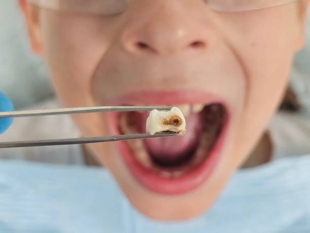 Best Emergency Tooth Extraction  in Lake Telemark, NJ